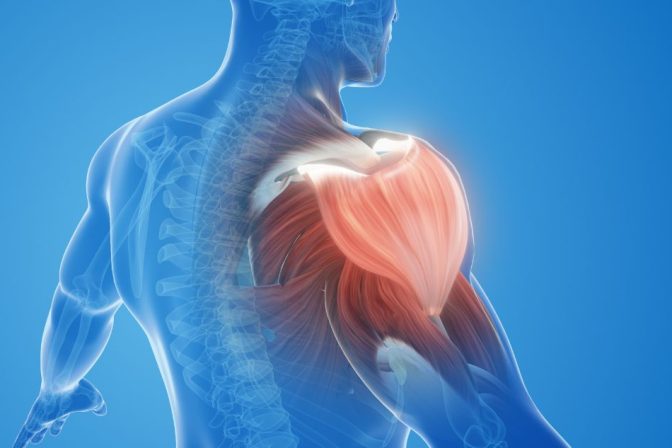 Mišićna slabost usled oštećenja mozga i moždanog stabla