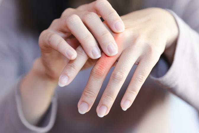 Reumatoidni artritis – bol u zglobovima i zašto je važno na vreme otići kod reumatologa